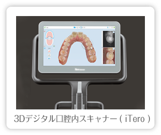 3Dデジタル口腔内スキャナー ( iTero )